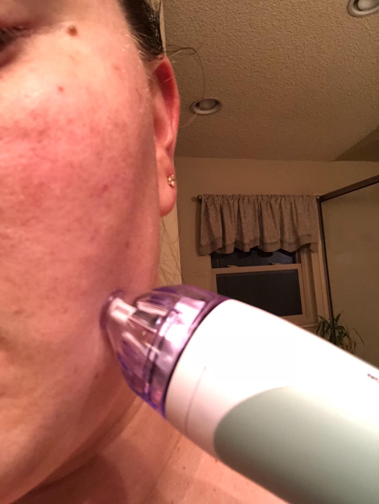 PMD Beauty Personal Microderm Classic - At-Home Use, Facial Exfoliator Tool, Microdermabrasion Machine Kit for Face and Body Skincare customer photo 2