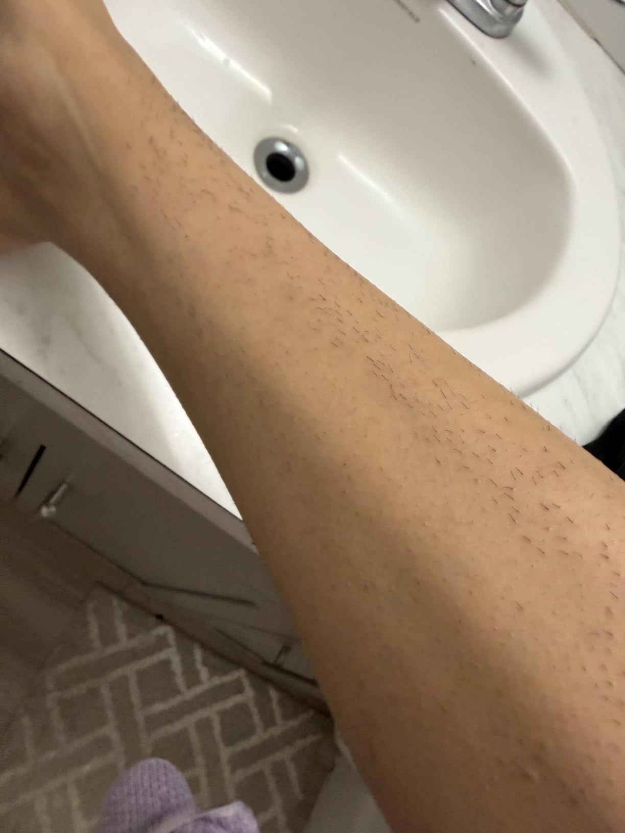 Braun IPL, Silk·Expert Pro 5, IPL Hair Removal for Women and Men, Permanent Laser Hair Reduction At-Home, 2 Heads, Pouch, IPL5137 customer photo 2
