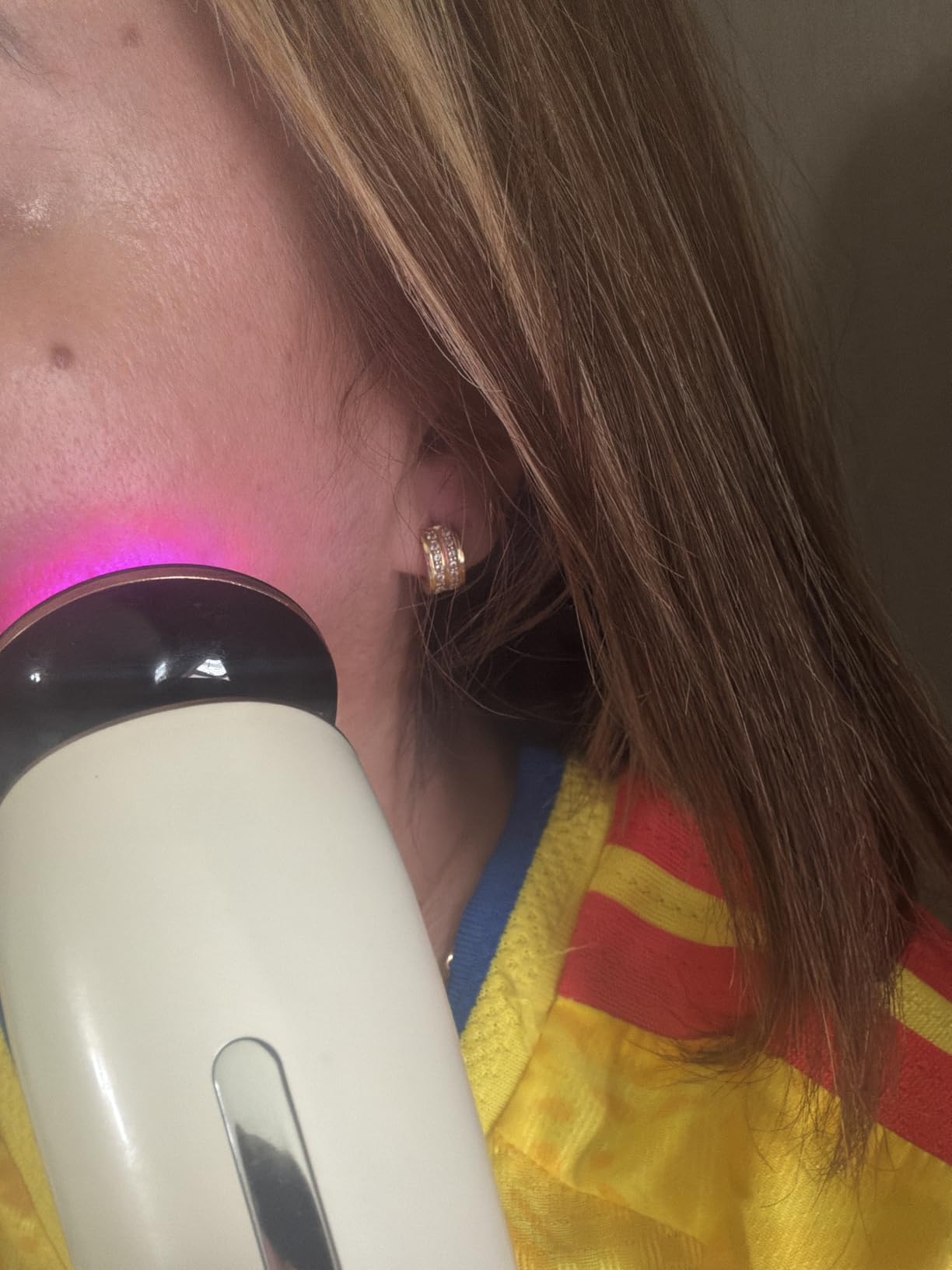 INIA FLARE 3-in-1 Red Light Therapy Beauty Device for Face & Neck White customer photo 2