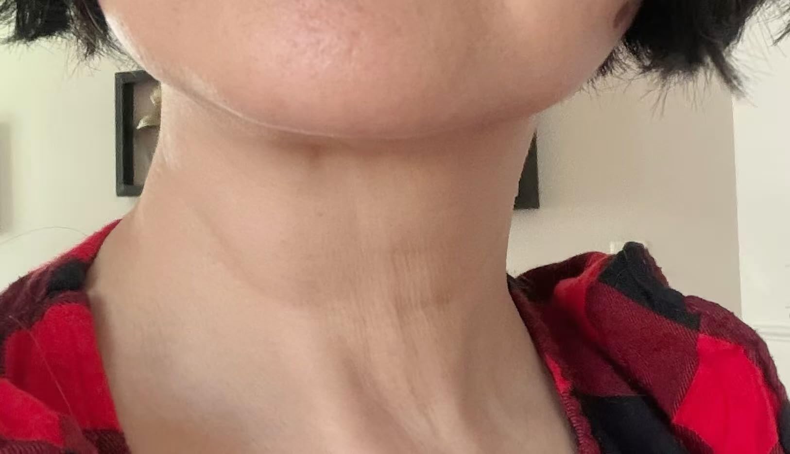 7-in-1 Microcurrent Facial Device, Red Light Face & Neck Massager customer photo 2